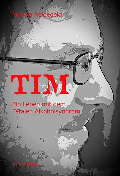 Tim-FASD